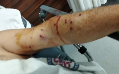 İzmir’de Tır Sahibinin Kantar Ücretine Kızarak Çalışanını Yaraladı