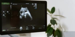 Kadın Doğum Uzmanlarına ‘Kürtaj Yapmayın’ Baskısı Devam Ediyor